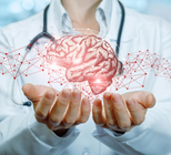 מפרצת מוחית - תמונת המחשה